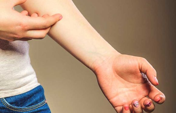 What is occupational dermatitis?