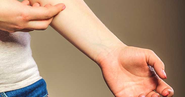 What is occupational dermatitis?